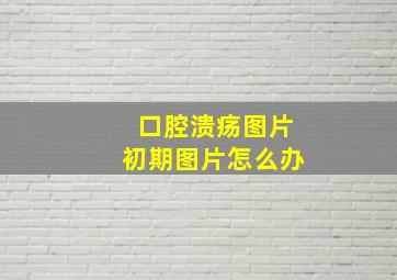 口腔溃疡图片初期图片怎么办