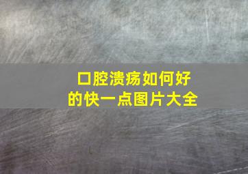 口腔溃疡如何好的快一点图片大全