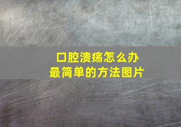 口腔溃疡怎么办最简单的方法图片