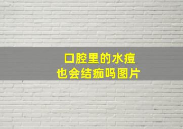 口腔里的水痘也会结痂吗图片