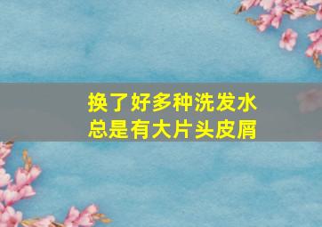 换了好多种洗发水总是有大片头皮屑