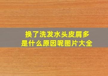 换了洗发水头皮屑多是什么原因呢图片大全