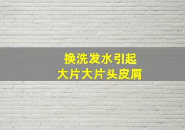 换洗发水引起大片大片头皮屑