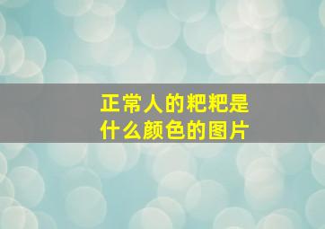 正常人的粑粑是什么颜色的图片