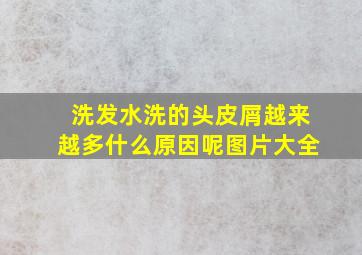 洗发水洗的头皮屑越来越多什么原因呢图片大全