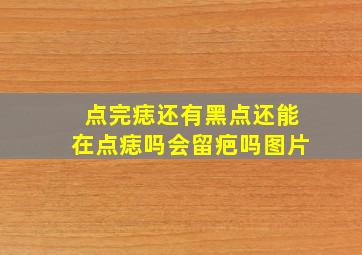 点完痣还有黑点还能在点痣吗会留疤吗图片