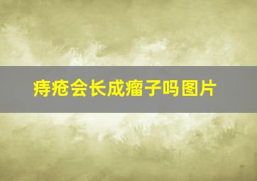 痔疮会长成瘤子吗图片