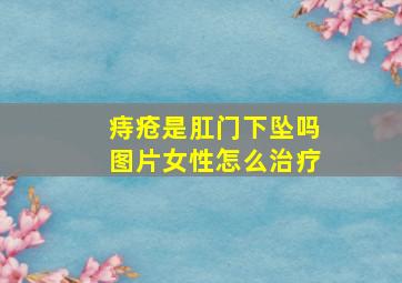 痔疮是肛门下坠吗图片女性怎么治疗