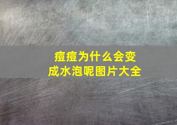 痘痘为什么会变成水泡呢图片大全