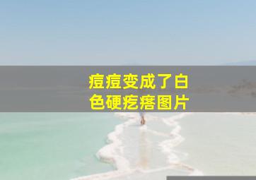 痘痘变成了白色硬疙瘩图片