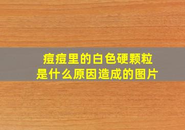 痘痘里的白色硬颗粒是什么原因造成的图片