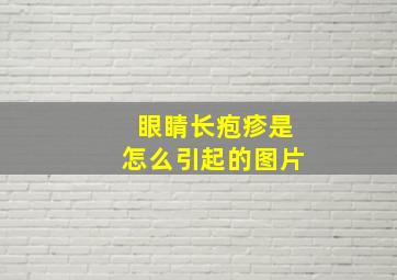 眼睛长疱疹是怎么引起的图片