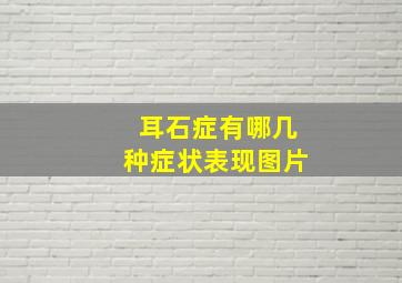 耳石症有哪几种症状表现图片