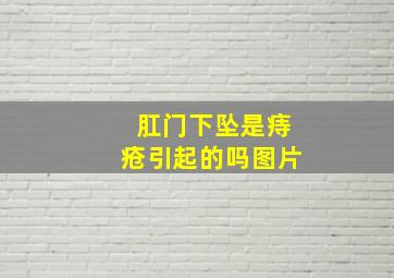 肛门下坠是痔疮引起的吗图片