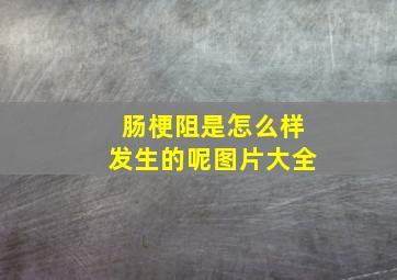 肠梗阻是怎么样发生的呢图片大全