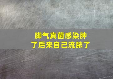 脚气真菌感染肿了后来自己流脓了