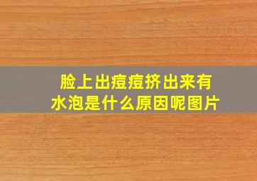 脸上出痘痘挤出来有水泡是什么原因呢图片