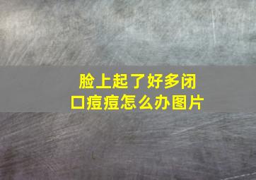 脸上起了好多闭口痘痘怎么办图片